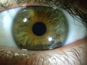 Irisdiagnose Irisdiagnose